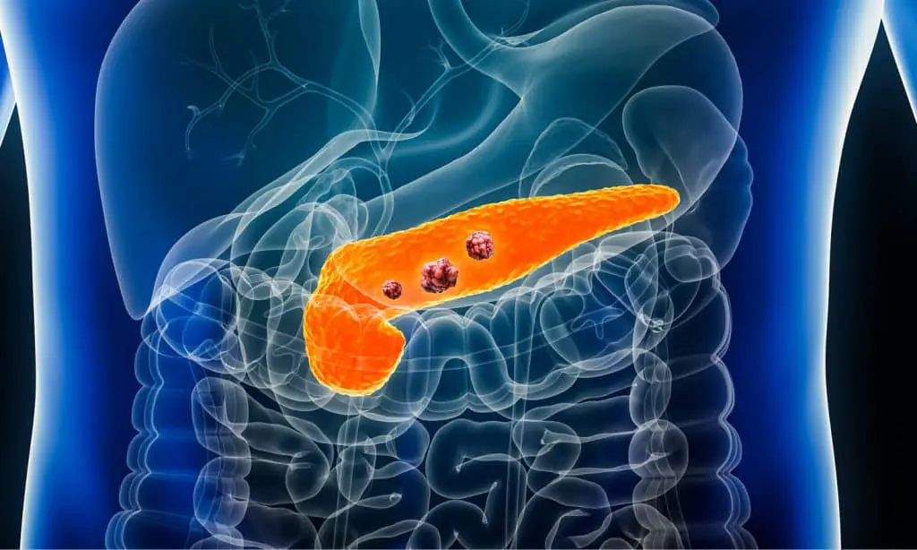 Cancro al pancreas: guida ai sintomi più subdoli, le terapie più efficaci, le cliniche più all'avanguardia %cancro al pancreas: guida ai sintomi più subdoli, le terapie più efficaci, le cliniche più all'avanguardiacount(title)% Cancro al pancreas: guida ai sintomi più subdoli, le terapie più efficaci, le cliniche più all'avanguardia