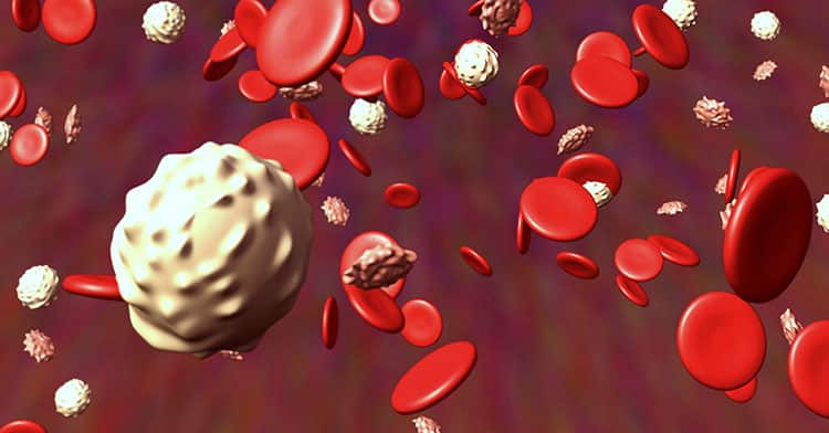 Leucemia: una sostanza presente nelle bevande energetiche alimenta le cellule leucemiche %leucemia: una sostanza presente nelle bevande energetiche alimenta le cellule leucemichecount(title)% Leucemia: una sostanza presente nelle bevande energetiche alimenta le cellule leucemiche