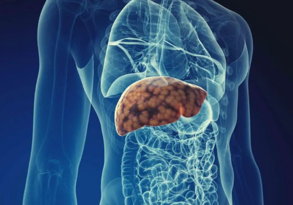 Semaglutide: svolta nella cura della malattia epatica in 2/3 dei pazienti %semaglutide: svolta nella cura della malattia epatica in 2/3 dei pazienticount(title)% Semaglutide: svolta nella cura della malattia epatica in 2/3 dei pazienti