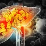 Fibrosi epatica: olr1 nei macrofagi è un nuovo bersaglio? %fibrosi epatica: olr1 nei macrofagi è un nuovo bersaglio? Count(title)% Fibrosi epatica: olr1 nei macrofagi è un nuovo bersaglio?