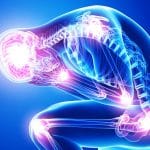 Fibromialgia: top 5 delle terapie più innovative ed efficaci