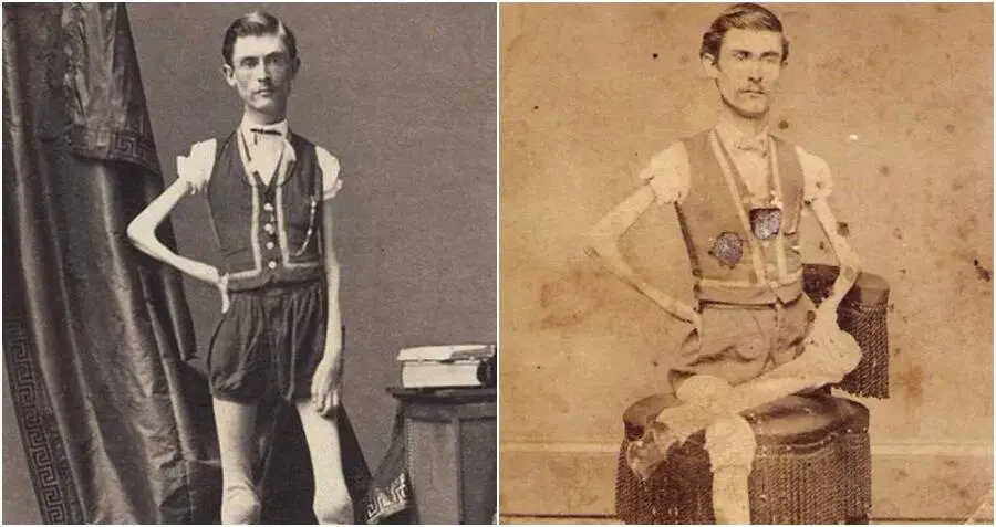 Benito alvarado: l'uomo fuori da ogni canone estetico al quale nessuna donna riusciva a resistere %benito alvarado: l'uomo fuori da ogni canone estetico al quale nessuna donna riusciva a resisterecount(title)% Benito alvarado: l'uomo fuori da ogni canone estetico al quale nessuna donna riusciva a resistere