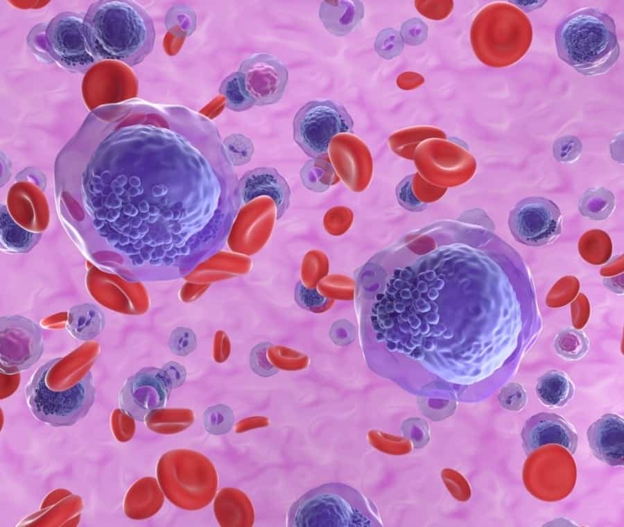 Leucemia: una sostanza presente nelle bevande energetiche alimenta le cellule leucemiche %leucemia: una sostanza presente nelle bevande energetiche alimenta le cellule leucemichecount(title)% Leucemia: una sostanza presente nelle bevande energetiche alimenta le cellule leucemiche