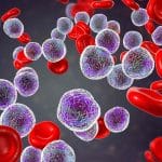 Inibitori parp e leucemie secondarie: quanto conta il carboplatino? %inibitori parp e leucemie secondarie: quanto conta il carboplatino? Count(title)% Inibitori parp e leucemie secondarie: quanto conta il carboplatino?
