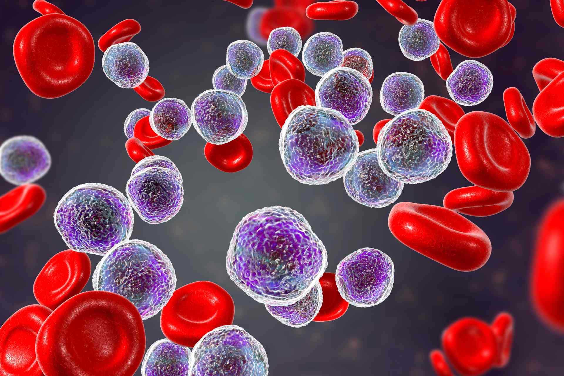 Leucemia: svelato il meccanismo di sopravvivenza delle cellule cancerose