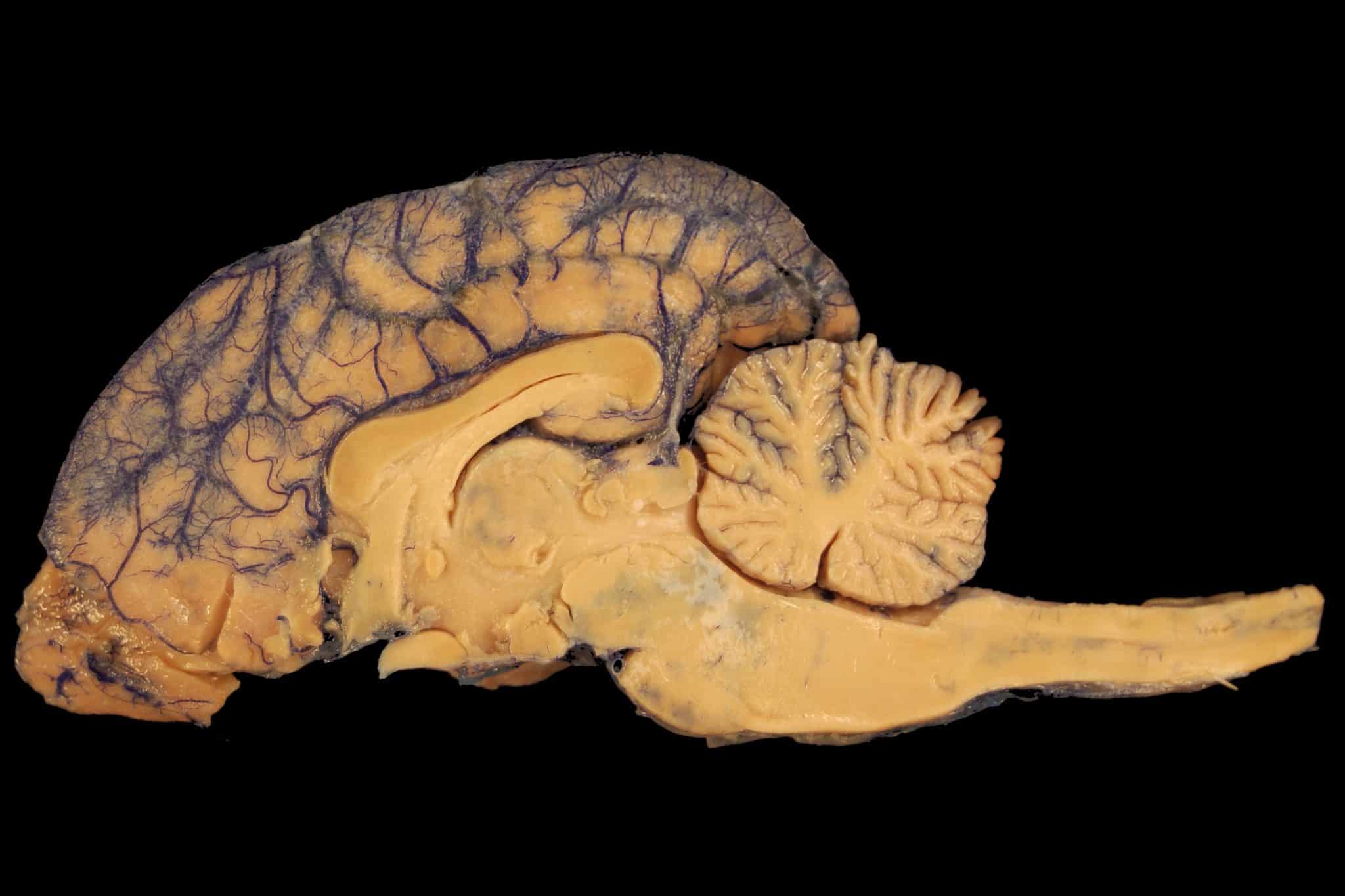 Cervelletto