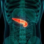 Tumore al pancreas: vcn-01 con chemio allunga la sopravvivenza?
