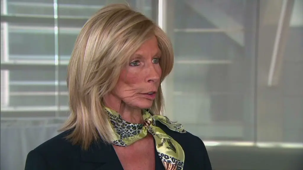 Terrie linn mcnutt hall, l'orrore del fumo iniziato a 17 anni: 11 tumori e un viso sfigurato da 48 interventi- foto