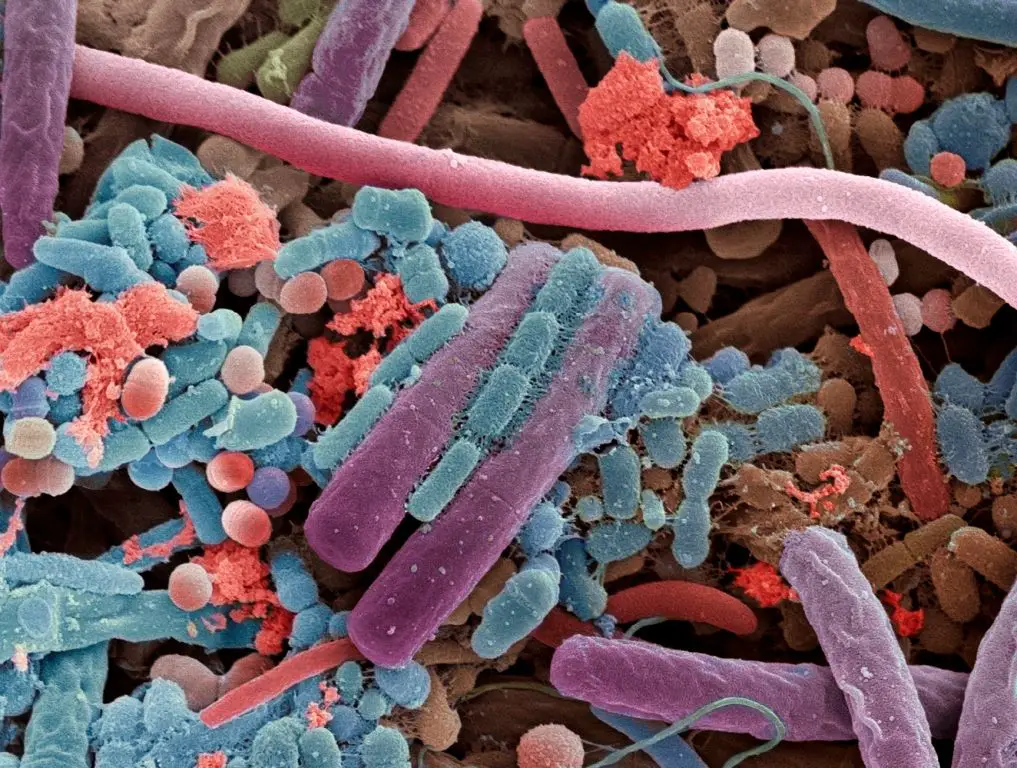 Disbiosi intestinale: guida ai sintomi più subdoli, alle strategie per la remissione, alle terapie più efficaci %disbiosi intestinale: guida ai sintomi più subdoli, alle strategie per la remissione, alle terapie più efficacicount(title)% Disbiosi intestinale: guida ai sintomi più subdoli, alle strategie per la remissione, alle terapie più efficaci