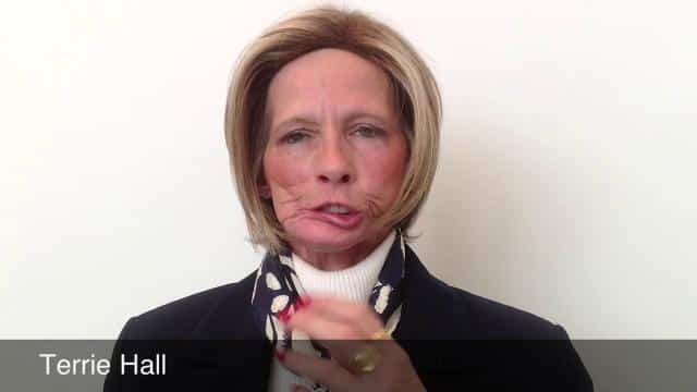 Terrie linn mcnutt hall, l'orrore del fumo iniziato a 17 anni: 11 tumori e un viso sfigurato da 48 interventi- foto