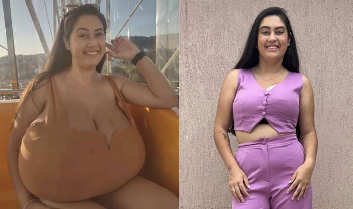 Thay marcondes: un seno di 12 chili, una vita di dolori fisici, umiliazioni e approcci sessuali indesiderati -foto %thay marcondes: un seno di 12 chili, una vita di dolori fisici, umiliazioni e approcci sessuali indesiderati -fotocount(title)% Thay marcondes: un seno di 12 chili, una vita di dolori fisici, umiliazioni e approcci sessuali indesiderati -foto