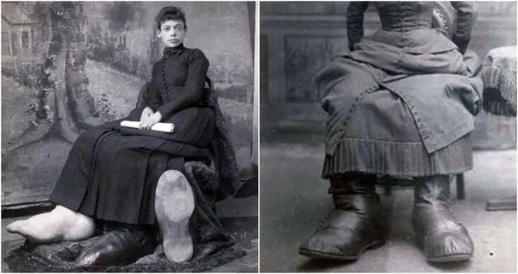 Fanny mills, la donna dai piedi giganteschi: una storia di mortificazioni, abus e bramosie sessuali dei "fan"-foto %fanny mills, la donna dai piedi giganteschi: una storia di mortificazioni, abus e bramosie sessuali dei "fan"-fotocount(title)% Fanny mills, la donna dai piedi giganteschi: una storia di mortificazioni, abus e bramosie sessuali dei "fan"-foto
