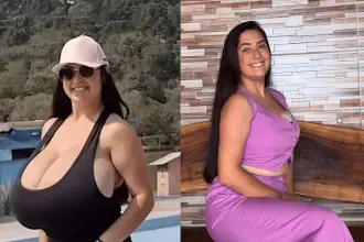 Thay marcondes: un seno di 12 chili, una vita di dolori fisici, umiliazioni e approcci sessuali indesiderati -foto