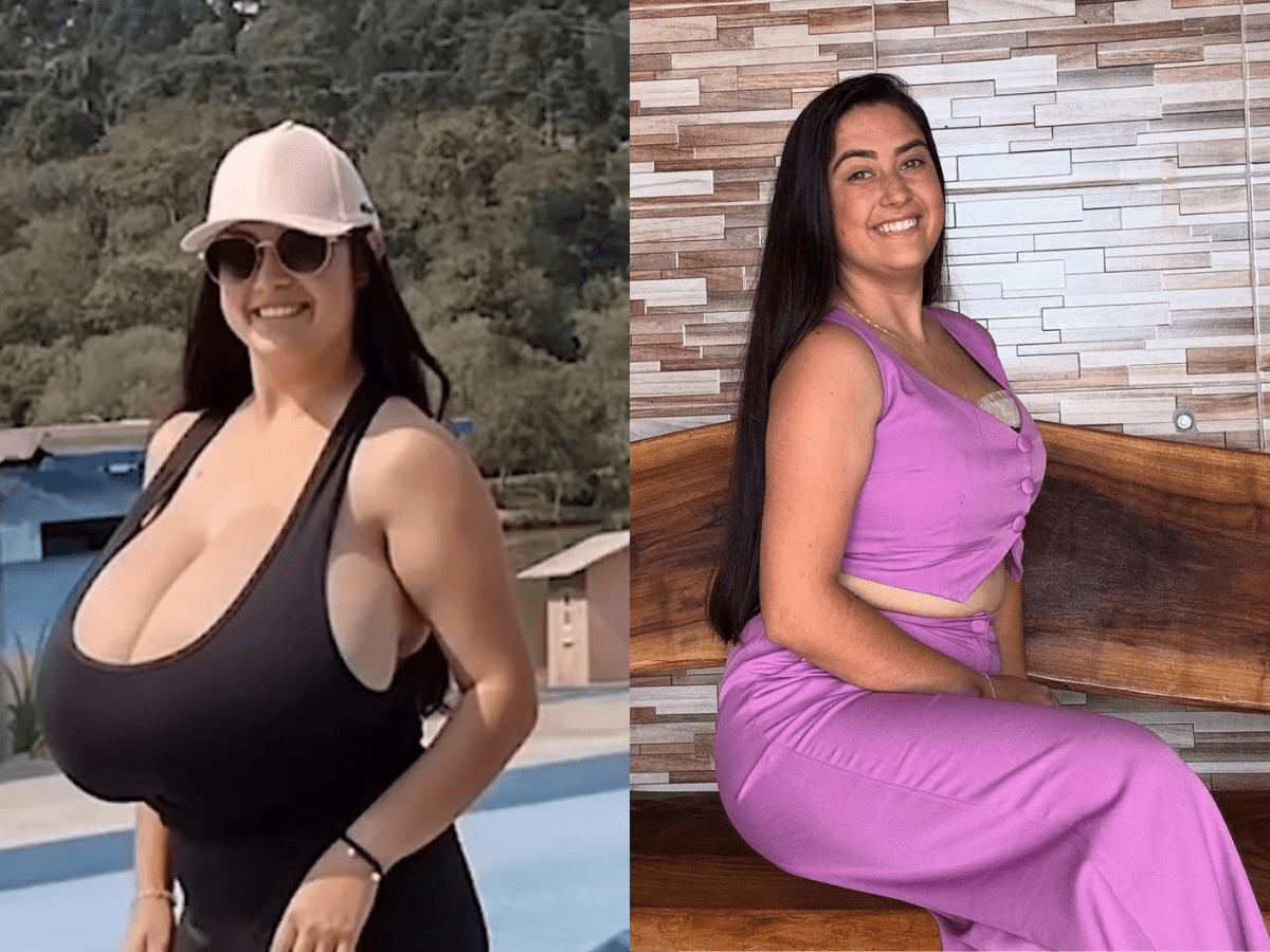 Thay marcondes: un seno di 12 chili, una vita di dolori fisici, umiliazioni e approcci sessuali indesiderati -foto
