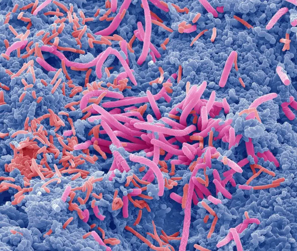 Disbiosi intestinale: guida ai sintomi più subdoli, alle strategie per la remissione, alle terapie più efficaci %disbiosi intestinale: guida ai sintomi più subdoli, alle strategie per la remissione, alle terapie più efficacicount(title)% Disbiosi intestinale: guida ai sintomi più subdoli, alle strategie per la remissione, alle terapie più efficaci