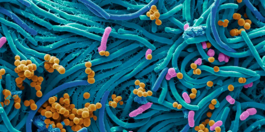 Disbiosi intestinale: guida ai sintomi più subdoli, alle strategie per la remissione, alle terapie più efficaci %disbiosi intestinale: guida ai sintomi più subdoli, alle strategie per la remissione, alle terapie più efficacicount(title)% Disbiosi intestinale: guida ai sintomi più subdoli, alle strategie per la remissione, alle terapie più efficaci