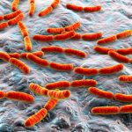 Deficit di alfa-1 antitripsina: può favorire l'infiammazione intestinale?