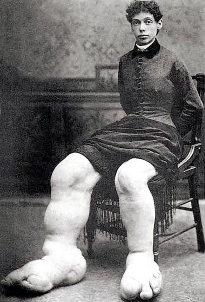 Fanny mills, la donna dai piedi giganteschi: una storia di mortificazioni, abus e bramosie sessuali dei "fan"-foto %fanny mills, la donna dai piedi giganteschi: una storia di mortificazioni, abus e bramosie sessuali dei "fan"-fotocount(title)% Fanny mills, la donna dai piedi giganteschi: una storia di mortificazioni, abus e bramosie sessuali dei "fan"-foto