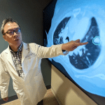 Iseg: l’ia che “vede” i tumori polmonari meglio dei medici