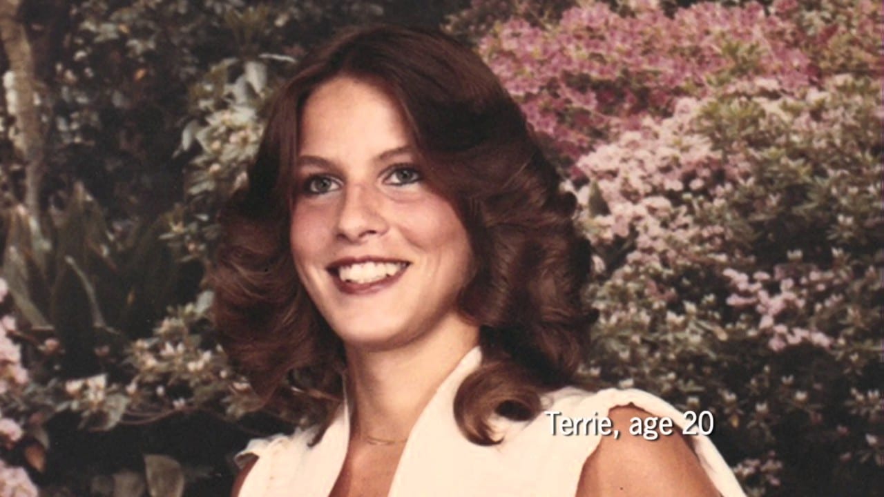 Terrie linn mcnutt hall, l'orrore del fumo iniziato a 17 anni: 11 tumori e un viso sfigurato da 48 interventi- foto