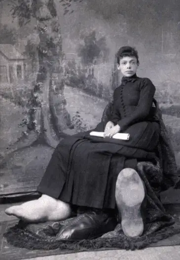Fanny mills, la donna dai piedi giganteschi: una storia di mortificazioni, abus e bramosie sessuali dei "fan"-foto %fanny mills, la donna dai piedi giganteschi: una storia di mortificazioni, abus e bramosie sessuali dei "fan"-fotocount(title)% Fanny mills, la donna dai piedi giganteschi: una storia di mortificazioni, abus e bramosie sessuali dei "fan"-foto