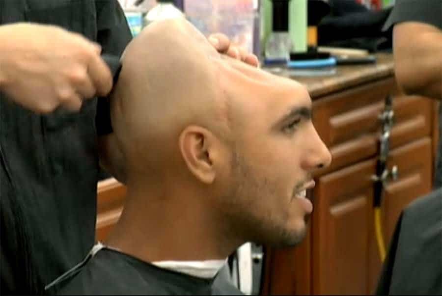 Carlos rodríguez detto "halfy": l'uomo com mezza testa -foto