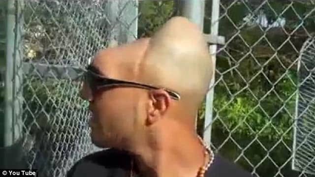 Carlos rodríguez detto "halfy": l'uomo com mezza testa -foto