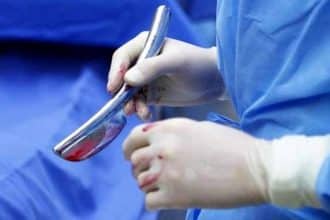 Lo strano caso dell'uomo di birmingham, affetto da triphallia ( aveva ben 3 peni)