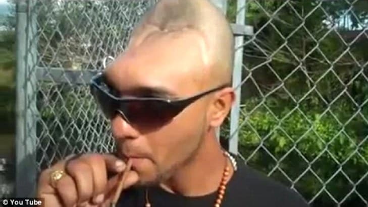 Carlos rodríguez detto "halfy": l'uomo com mezza testa -foto