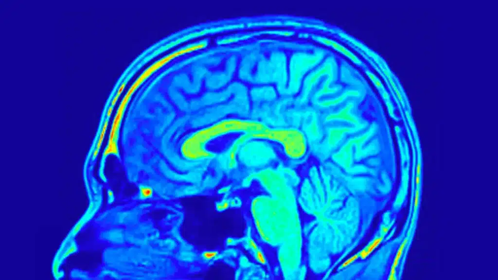 Il cervello umano invecchia meno di quanto pensi e lo fa “a strati” %il cervello umano invecchia meno di quanto pensi e lo fa “a strati”count(title)% Il cervello umano invecchia meno di quanto pensi e lo fa “a strati”