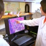 Metastasi durali: gli osteoclasti bloccano i linfatici meningei?