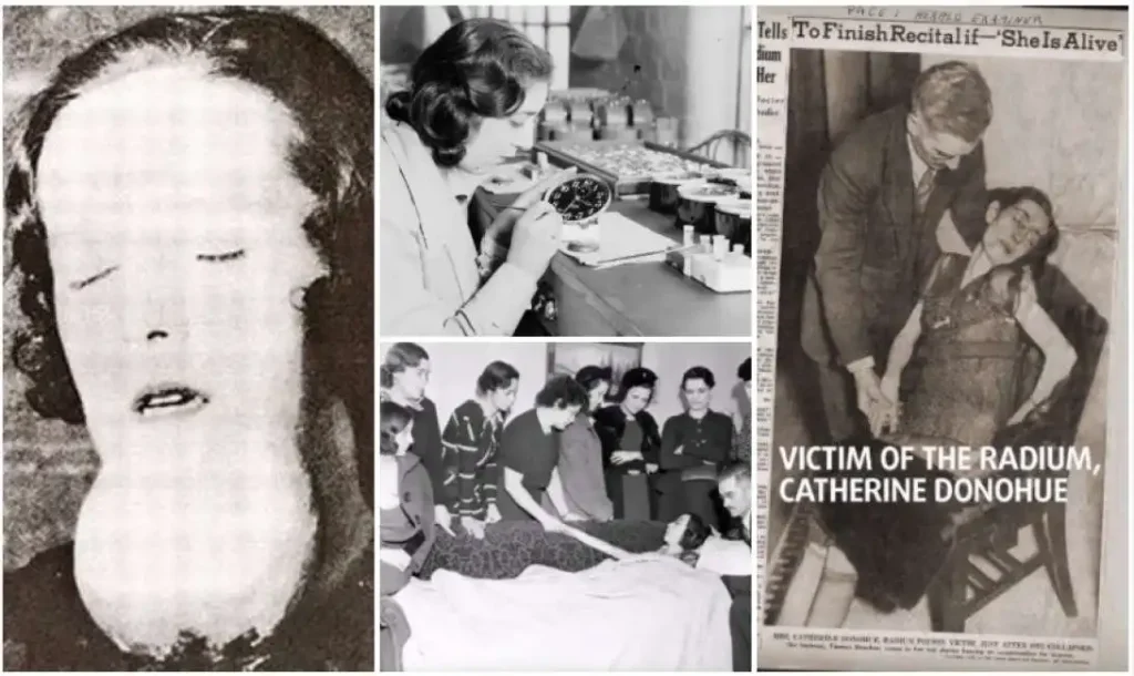 Radium girls: reclutate per un lavoro prestigioso, pagato con un volto sfigurato - foto