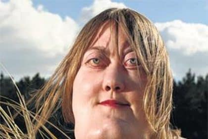 Victoria wright: un volto deturpato dal cherubismo, una vita di abusi e la voglia di aiutare gli altri - foto