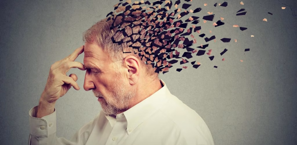 Alzheimer: il grasso nel cervello ostacola le difese immunitarie secondo una nuova ricerca