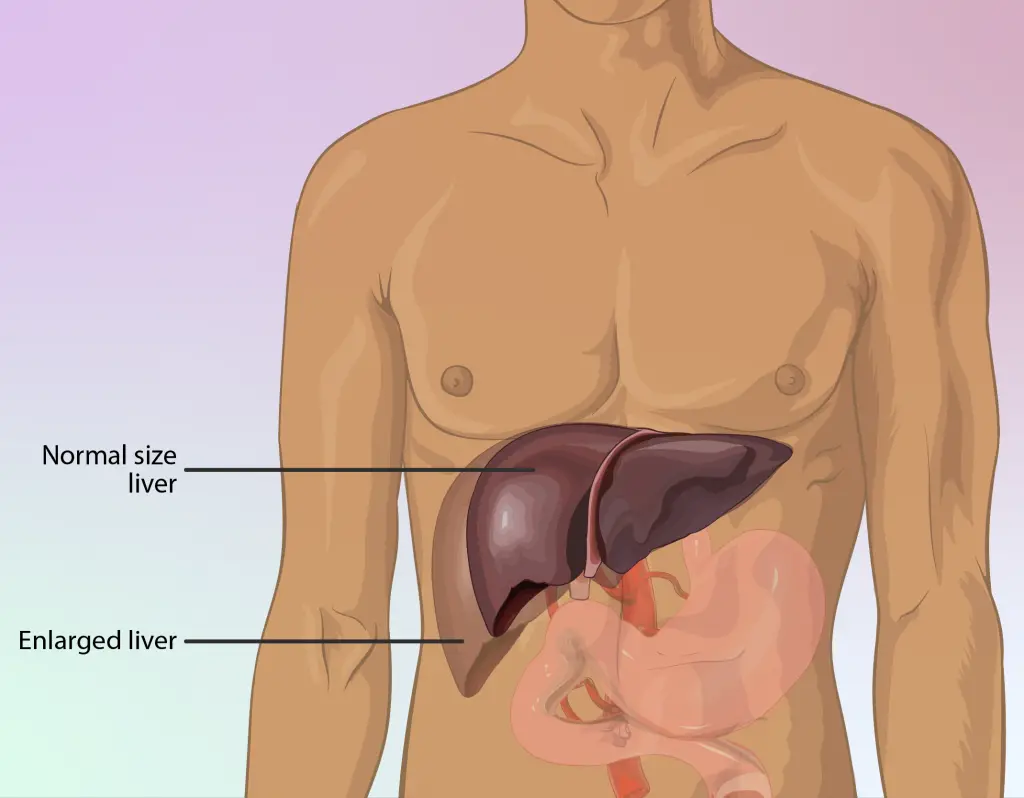 Scoperto il legame tra alcol e steatosi epatica: una proteina “chiave” nel mirino della mayo clinic %scoperto il legame tra alcol e steatosi epatica: una proteina “chiave” nel mirino della mayo cliniccount(title)% Scoperto il legame tra alcol e steatosi epatica: una proteina “chiave” nel mirino della mayo clinic