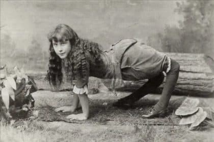 Ella harper: la "ragazza cammello" affetta da genu recurvatum, sfruttata e disumanizzata per compiacere il pubblico dei freak show - foto