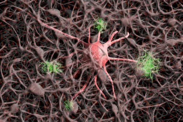 Alzheimer: il grasso nel cervello ostacola le difese immunitarie secondo una nuova ricerca