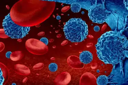 Ischemia