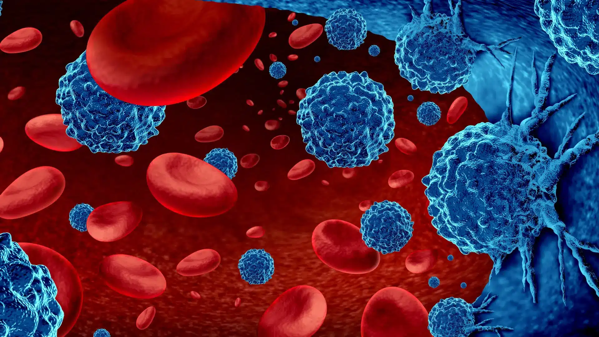 Ischemia