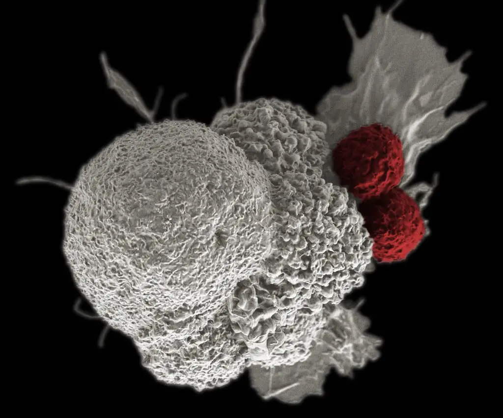 Cancro: un nuovo vaccino a nanoparticelle lo blocca prima ancora che nasca. Risultati shock dagli usa %cancro: un nuovo vaccino a nanoparticelle lo blocca prima ancora che nasca. Risultati shock dagli usacount(title)% Cancro: un nuovo vaccino a nanoparticelle lo blocca prima ancora che nasca. Risultati shock dagli usa