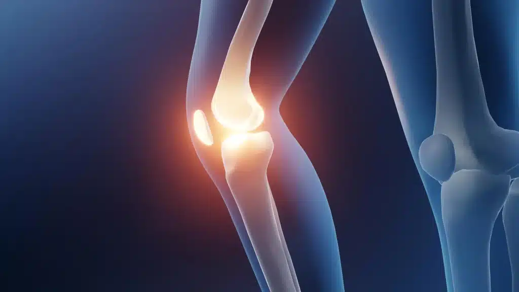 Artrosi al ginocchio: camminare, pedalare o nuotare è la terapia più efficace, secondo un nuovo studio %artrosi al ginocchio: camminare, pedalare o nuotare è la terapia più efficace, secondo un nuovo studiocount(title)% Artrosi al ginocchio: camminare, pedalare o nuotare è la terapia più efficace, secondo un nuovo studio