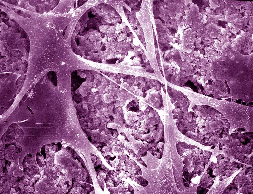 Mit e harvard: scoperta una nuova arma contro il cancro con le car-nk, cellule killer che non vengono rigettate dal sistema immunitario %mit e harvard: scoperta una nuova arma contro il cancro con le car-nk, cellule killer che non vengono rigettate dal sistema immunitariocount(title)% Mit e harvard: scoperta una nuova arma contro il cancro con le car-nk, cellule killer che non vengono rigettate dal sistema immunitario