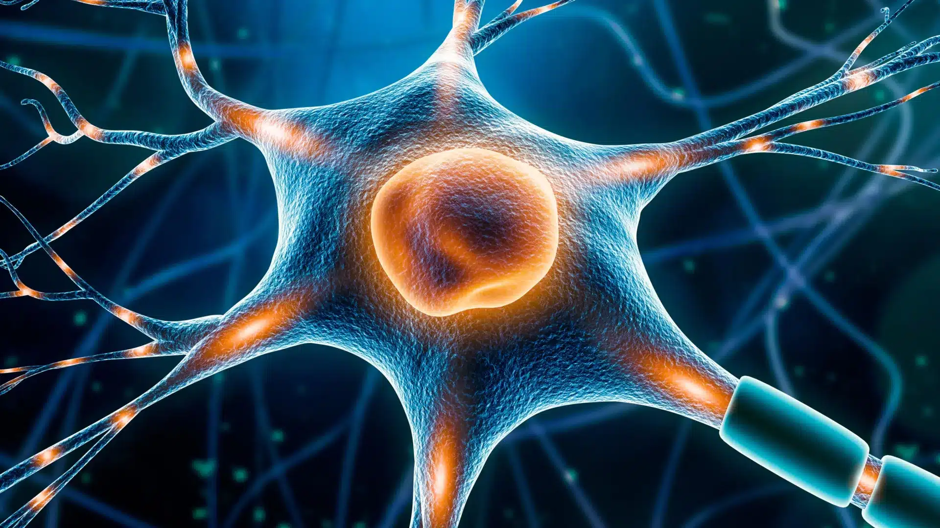 Parkinson