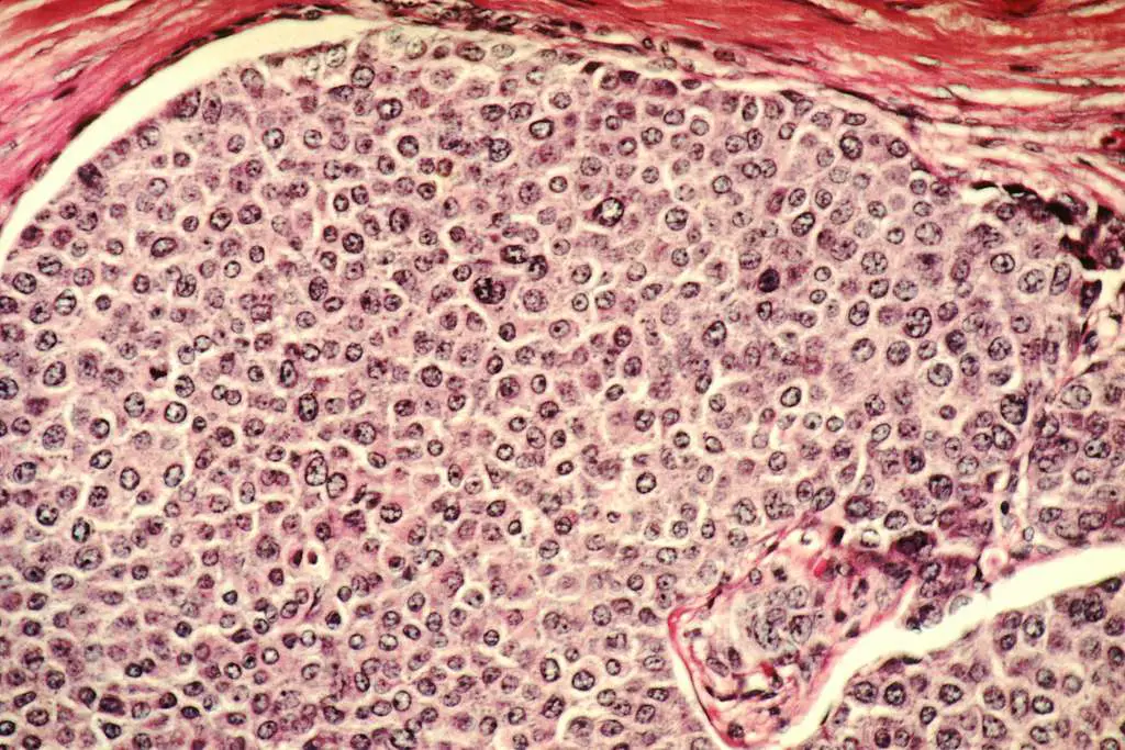 Cancro: un nuovo vaccino a nanoparticelle lo blocca prima ancora che nasca. Risultati shock dagli usa %cancro: un nuovo vaccino a nanoparticelle lo blocca prima ancora che nasca. Risultati shock dagli usacount(title)% Cancro: un nuovo vaccino a nanoparticelle lo blocca prima ancora che nasca. Risultati shock dagli usa