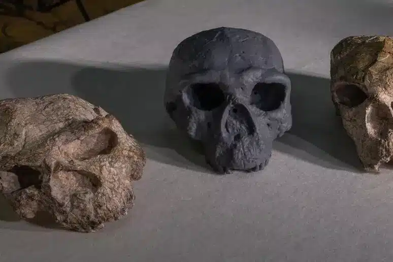 Cranio