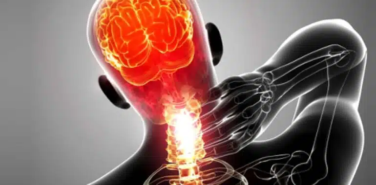 Sclerosi multipla: il sistema immunitario attacca il cervello anni prima dei sintomi, lo rivela uno studio di ucsf %sclerosi multipla: il sistema immunitario attacca il cervello anni prima dei sintomi, lo rivela uno studio di ucsfcount(title)% Sclerosi multipla: il sistema immunitario attacca il cervello anni prima dei sintomi, lo rivela uno studio di ucsf