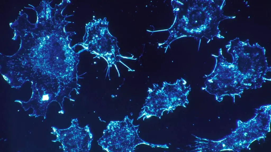 Mit e harvard: scoperta una nuova arma contro il cancro con le car-nk, cellule killer che non vengono rigettate dal sistema immunitario %mit e harvard: scoperta una nuova arma contro il cancro con le car-nk, cellule killer che non vengono rigettate dal sistema immunitariocount(title)% Mit e harvard: scoperta una nuova arma contro il cancro con le car-nk, cellule killer che non vengono rigettate dal sistema immunitario