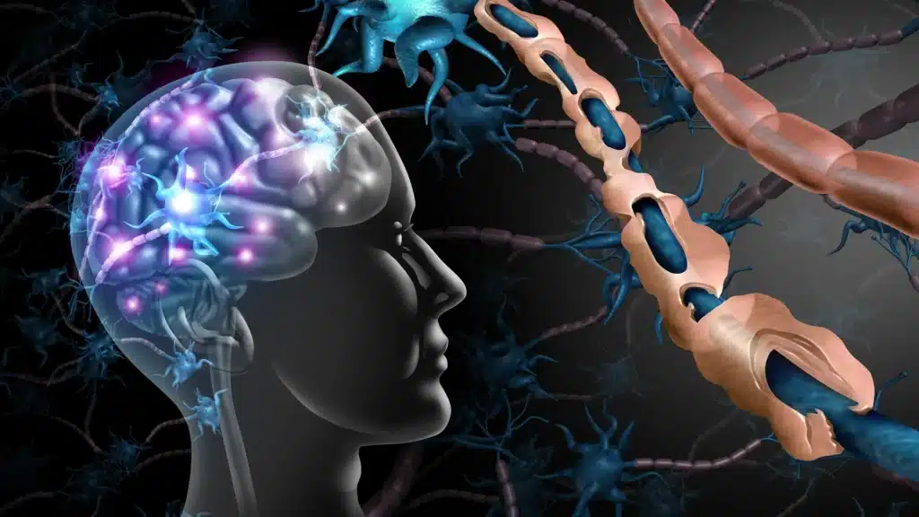 Sclerosi multipla: il sistema immunitario attacca il cervello anni prima dei sintomi, lo rivela uno studio di ucsf %sclerosi multipla: il sistema immunitario attacca il cervello anni prima dei sintomi, lo rivela uno studio di ucsfcount(title)% Sclerosi multipla: il sistema immunitario attacca il cervello anni prima dei sintomi, lo rivela uno studio di ucsf
