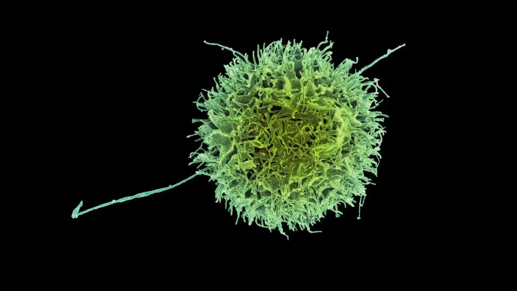 Mit e harvard: scoperta una nuova arma contro il cancro con le car-nk, cellule killer che non vengono rigettate dal sistema immunitario %mit e harvard: scoperta una nuova arma contro il cancro con le car-nk, cellule killer che non vengono rigettate dal sistema immunitariocount(title)% Mit e harvard: scoperta una nuova arma contro il cancro con le car-nk, cellule killer che non vengono rigettate dal sistema immunitario