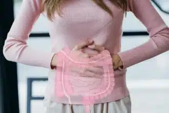 Anemia